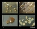 bacteria photos